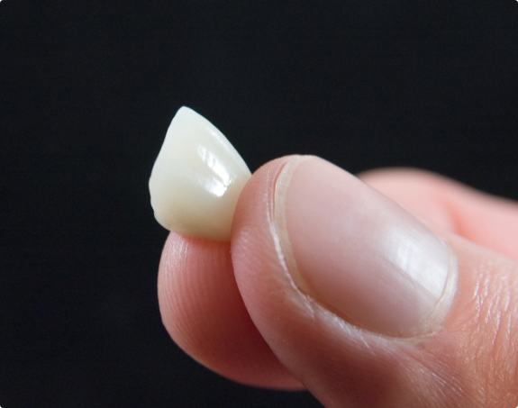 Hand holding a metal free dental restoration