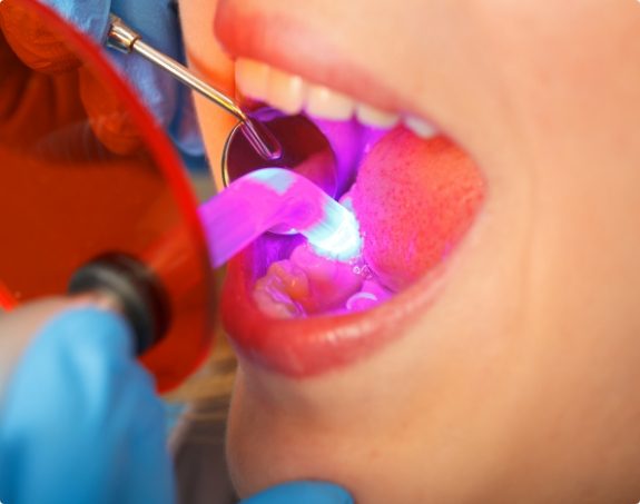 Dental patient receiving cosmetic dental bonding