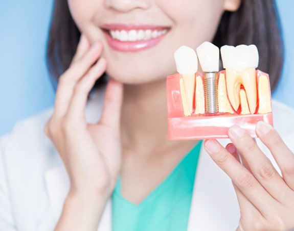 A dentist holding a dental implant model or mockup