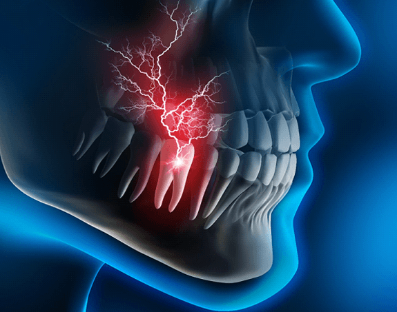 illustration of dental emergency