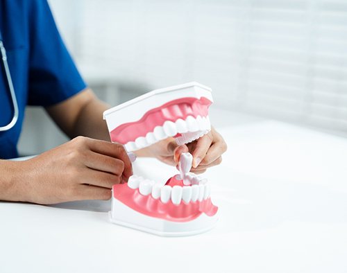 Dental assistant showing tooth extraction on model of mouth